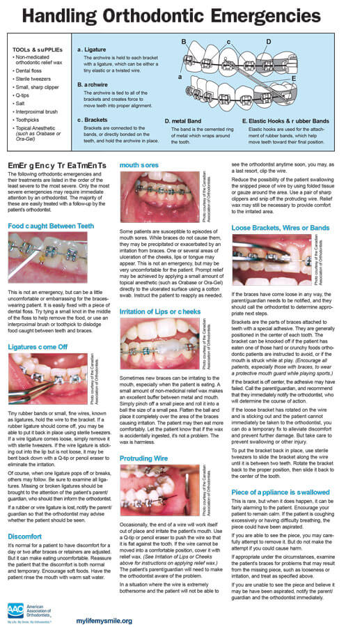 What to do if I Have an Orthodontic Emergency?